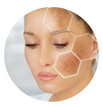 درمان پوست و مو دکتر فرزانه دانش